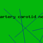 artery carotid neck pain