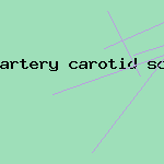 artery carotid scan